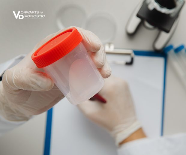 Containers for taking samples of urine and feces